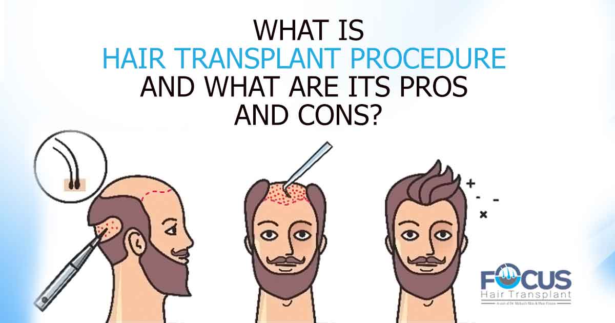 What is Hair Transplant Procedure and what are its pros and cons?