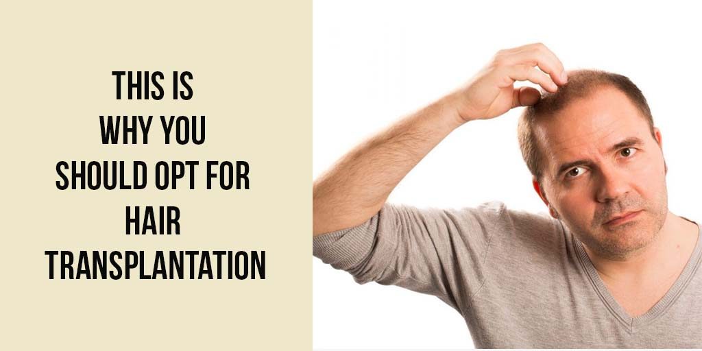 This is Why You Should Opt For Hair Transplantation