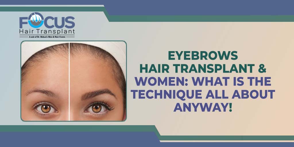 Eyebrows Hair Transplant & Women: What is the Technique All About Anyway!