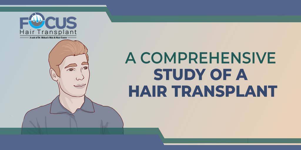 A Comprehensive Study of a Hair Transplant