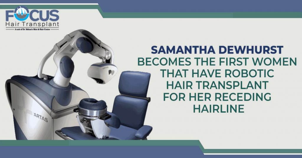 Samantha Dewhurst Becomes The First Women That Have Robotic Hair Transplant For Her Receding Hairline