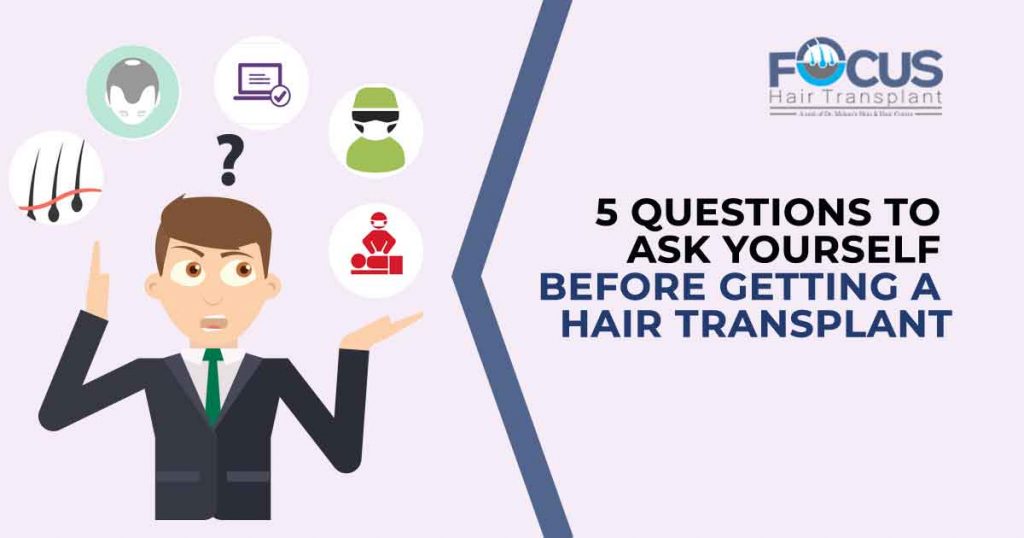 5 Questions to Ask Yourself Before Getting a Hair Transplant