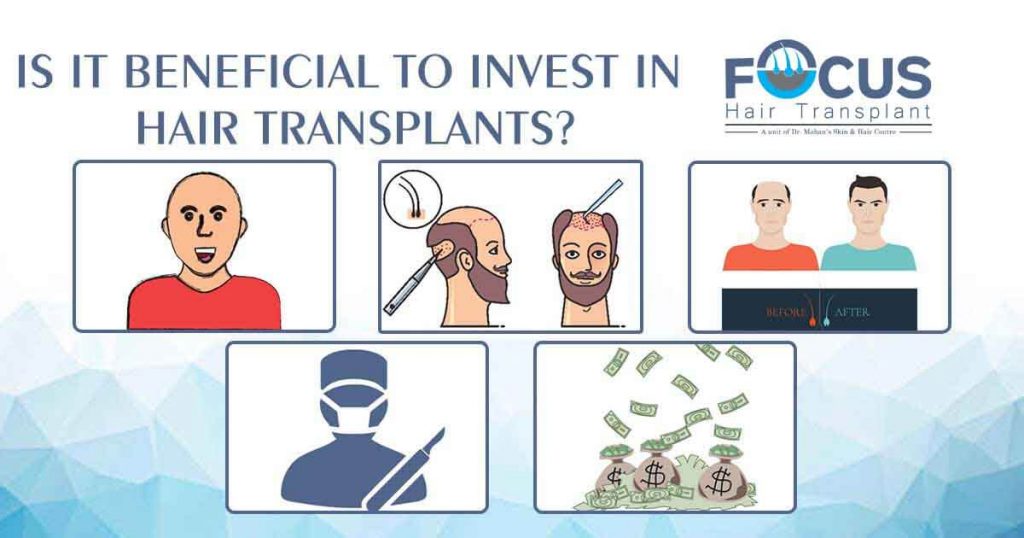 Is it beneficial to invest in Hair Transplants?