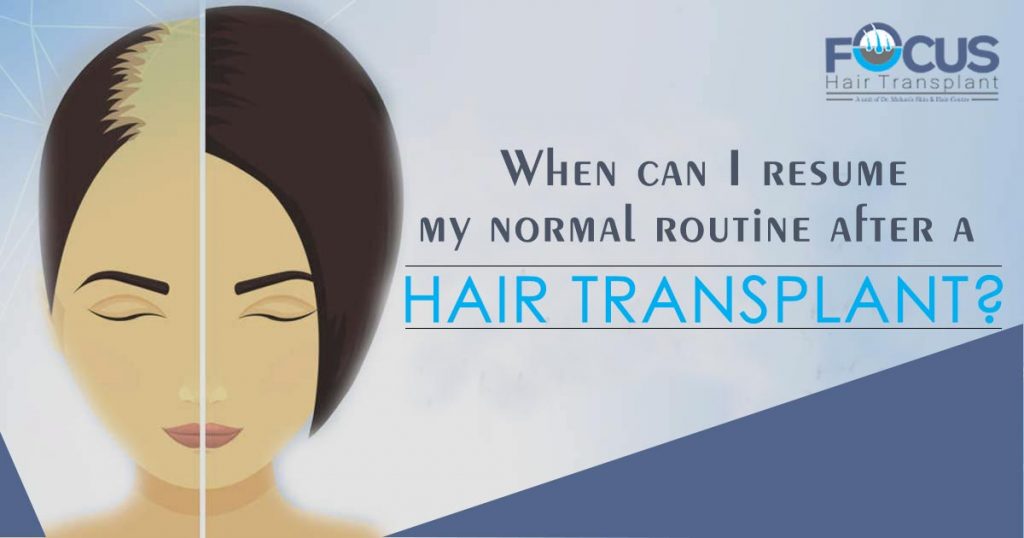When-can-I-resume-my-normal-routine-after-a-Hair-Transplant-1
