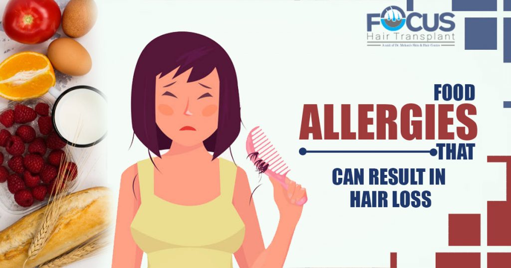Food Allergies That Can Result in Hair loss