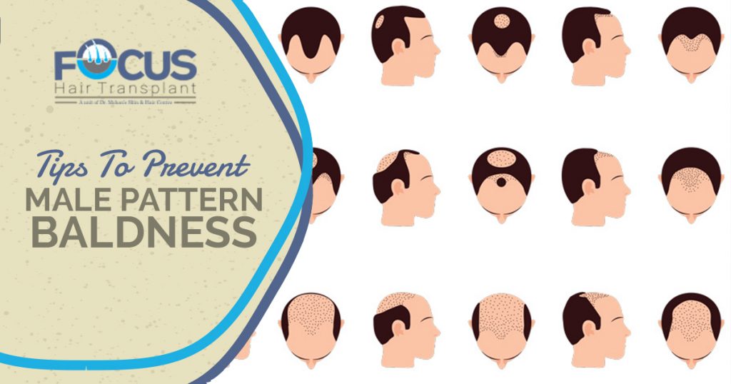 Tips To Prevent Male Pattern Baldness