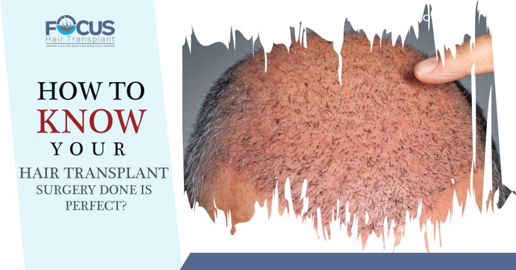 How to know your hair transplant surgery done is perfect