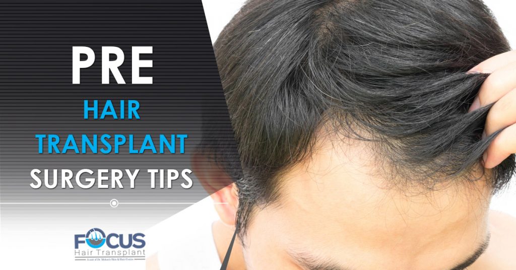 Pre hair Transplant surgery tips