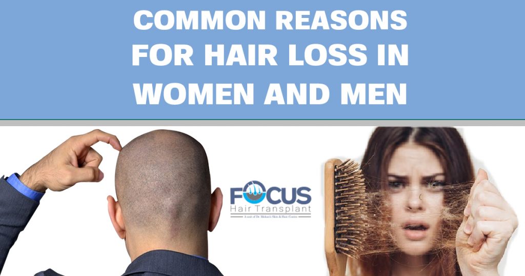 Causes of Hair Loss in Women and Men