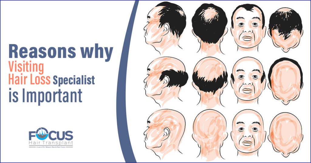 Reasons why visiting hair loss specialist is important