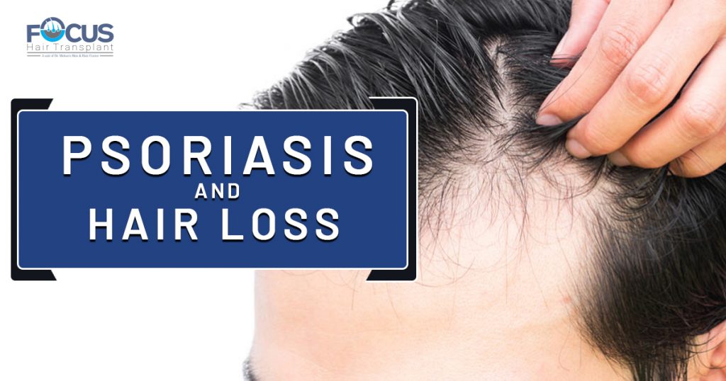 Psoriasis And hair loss